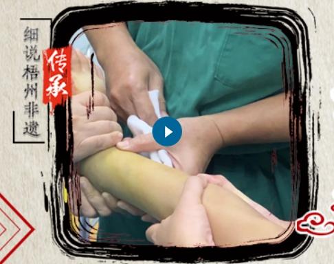 妙手正骨法 仁术远流长